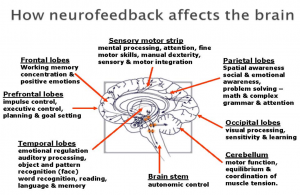 neurofeedback_BRAIN_AFFECTS_MAP_ENG